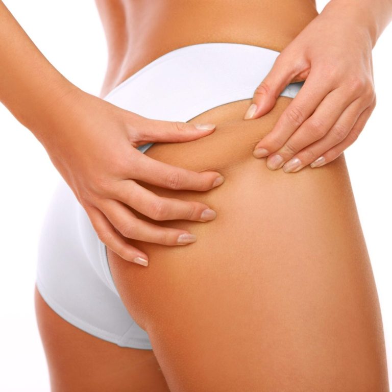 "Tratamiento corporal reductivo y reafirmante para celulitis y grasa localizada en centro de estética Esencia."
