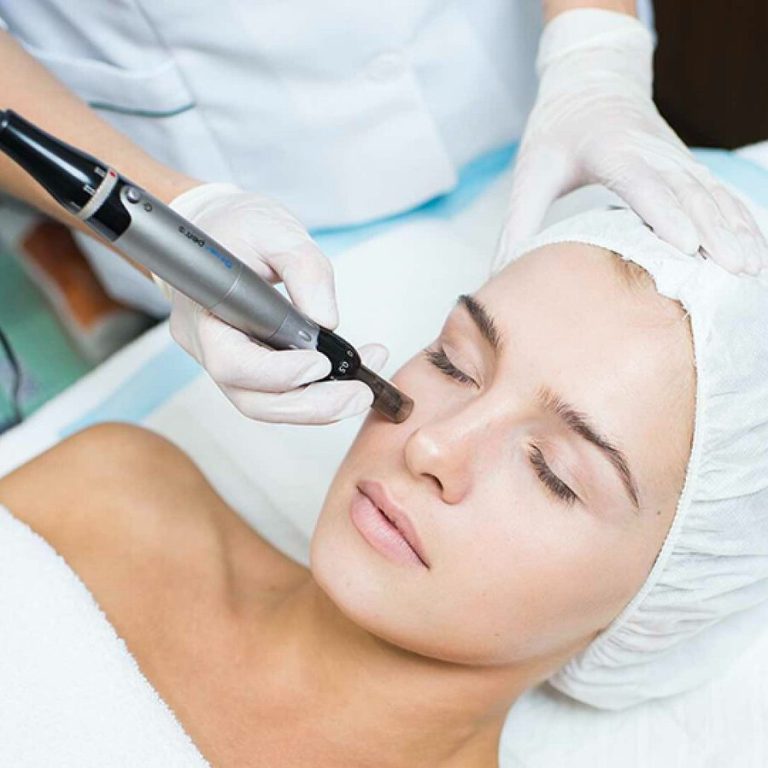 "Tratamiento facial con Dermapen para rejuvenecimiento y aporte de vitaminas en centro de estética Esencia."

"Aplicación de vitaminas con D