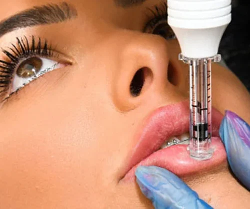 Hyaluron Pen labios

Aumento de labios sin agujas

Volumen labial sin inyecciones

Hidratación de labios

Ácido hialurónico sin dolor

Rejuv